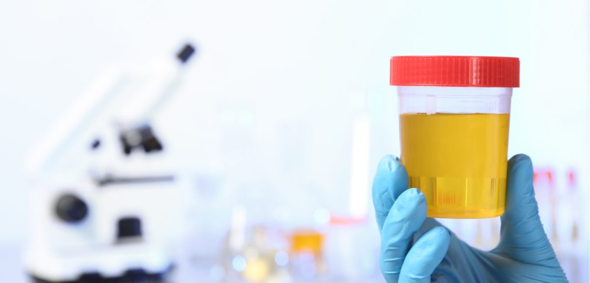 Are synthetic urine kits safe to use?